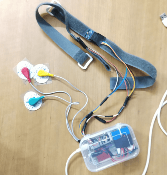 Smart Wearable for ACL Injury Prevention and Rehabilitation